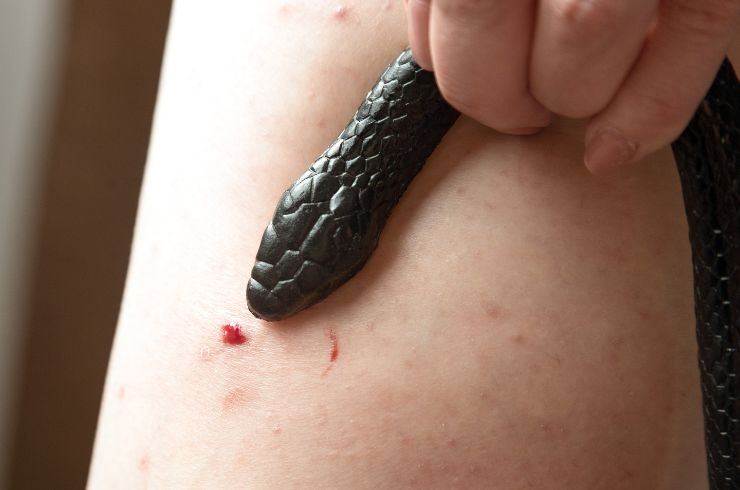 Snake Bite